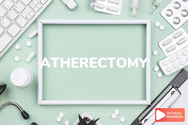 arti atherectomy adalah Teknik bedah minimal invasif untuk mengeluarkan sumbatan lemak (aterosklerosis) pada pembuluh darah. dalam kamus farmasi bahasa indonesia online by Aplikasi Indonesia