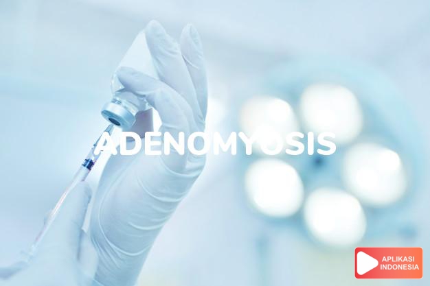 arti adenomyosis adalah <p>Juga dikenal sebagai “endometriosis rahim”, adenomyosis adalah pertumbuhan sel-sel endometrium yang menembus jauh ke dalam otot rahim (miometrium) di dinding belakang (sisi posterior). Rahim menjadi lebih besar hingga lebih dari dua kali ukuran normal dan sangat keras. Penyakit ini dapat dilokalisasi dengan definisi perbatasan yang jelas atau tidak jelas (difus). Adenomyosis bersifat jinak dan tidak menyebabkan kanker. Bila masih bersifat lokal, kondisinya disebut adenomyoma. Adenomyoma dapat terletak pada kedalaman yang berbeda dari otot rahim dan dapat menembus hingga ke dalam rongga rahim, menjadi tumor submukosa.</p><p>Adenomyosis hanya dapat didiagnosis dengan kepastian 100% melalui biopsiotot rahim. Sekitar 12% dari wanita penderita adenomyosis juga memiliki endometriosis pada tempat lain seperti dinding panggul, indung telur, tuba fallopi dll. Insiden tertinggi adenomyosis adalah pada wanita di pertengahan empat puluhan ke atas. Meskipun dapat menyebabkan infertilitas, penyakit ini umumnya muncul pada wanita yang telah memiliki anak.</p> dalam kamus kesehatan bahasa indonesia online by Aplikasi Indonesia